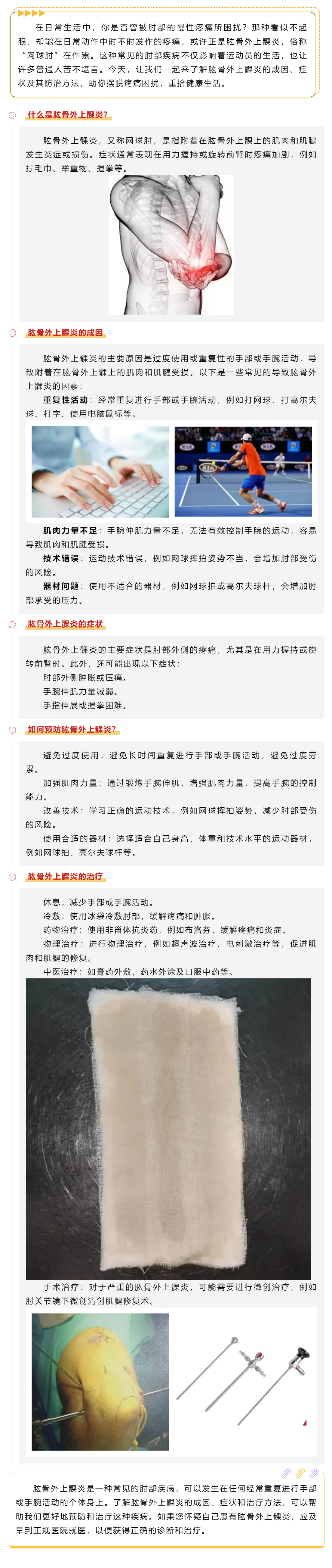 揭秘肘部隱痛之謎——認(rèn)識肱骨外上髁炎.png