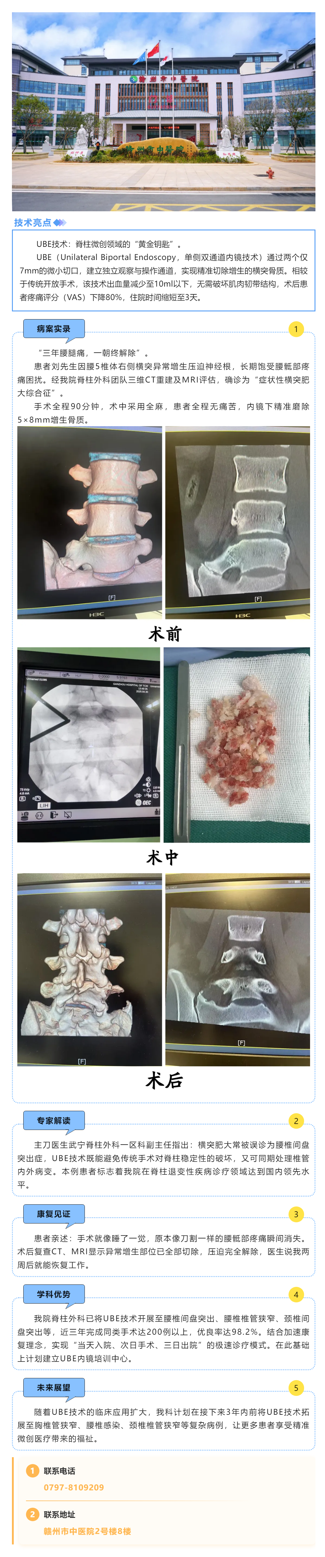 【微創(chuàng)突破】UBE內(nèi)鏡精準_拆彈_！腰5橫突肥大切除術(shù)后當(dāng)天即可下地.png